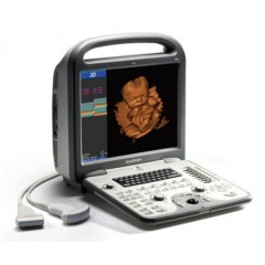 Аппарат УЗИ (сканер) Sonoscape S6 pro