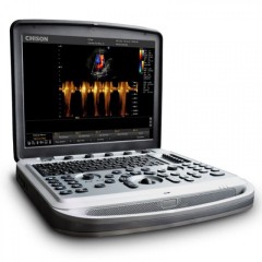 Аппарат УЗИ (сканер) Chison SonoTouch 80 Pro